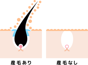 産毛がある場合とない場合のファンデーションの付きの違い